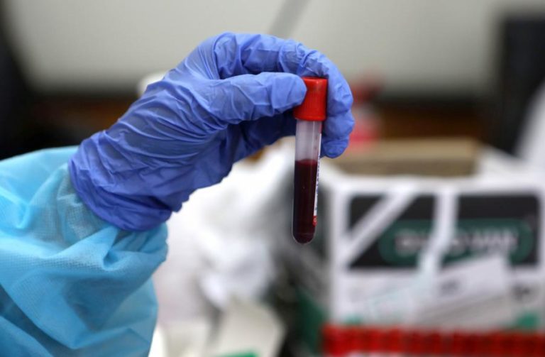 CAMPANHA ALERTA PARA A NECESSIDADE DE REUNIR ESFORÇOS NO COMBATE ÀS HEPATITES