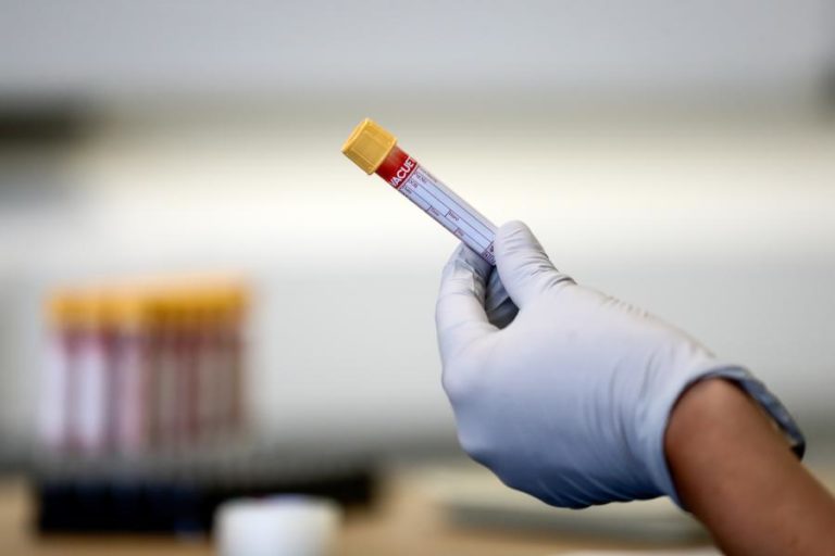 COVID-19: PORTUGAL REGISTA HOJE MAIS UM MORTO E 112 NOVOS CASOS DE INFEÇÃO