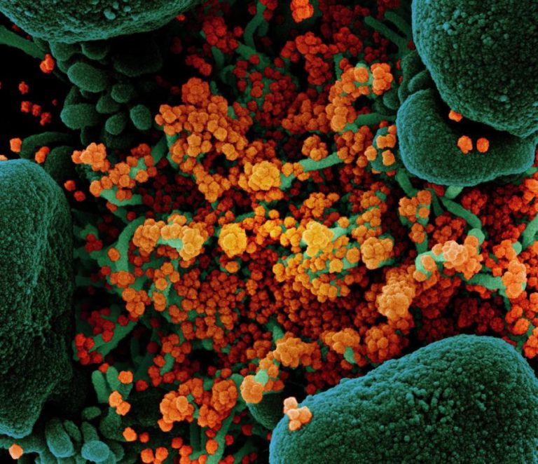 COVID-19: MAIS DE 898 MIL MORTOS E 27,6 MILHÕES DE INFETADOS EM TODO MUNDO