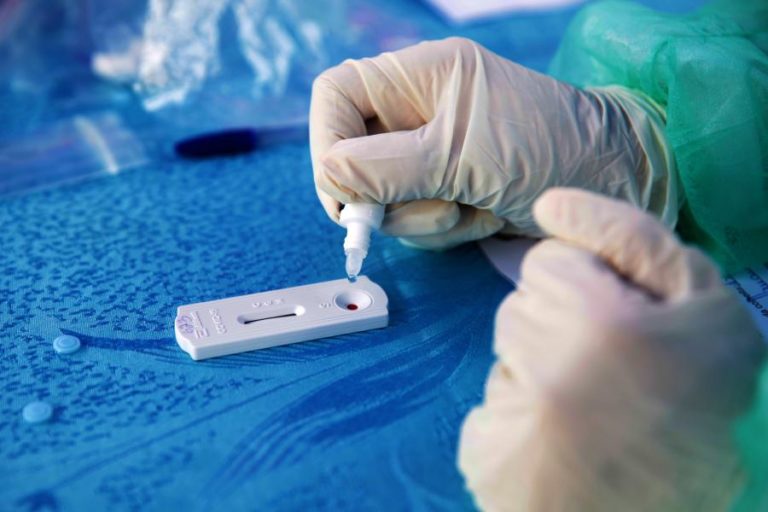 COVID-19: ÁFRICA COM MENOS 14% NOVOS CASOS EM RELAÇÃO À SEMANA ANTERIOR – CDC
