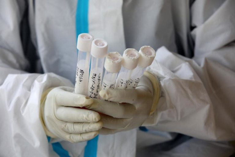 COVID-19: MAIS DE 7 MIL PROFISSIONAIS DE SAÚDE JÁ MORRERAM DURANTE A PANDEMIA – AMNISTIA