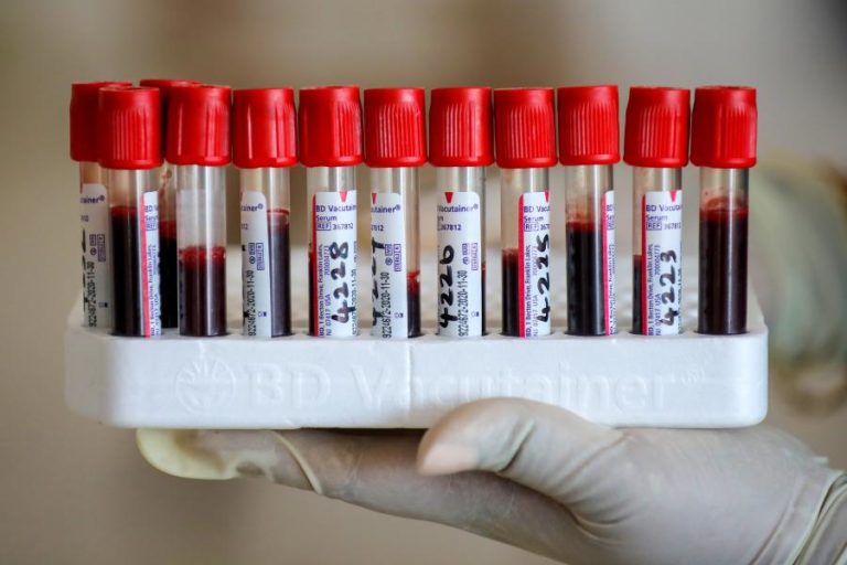 COVID-19: ONZE UTENTES E 5 PROFISSIONAIS INFETADOS EM UNIDADE DA MISERICÓRDIA DE LOUSADA