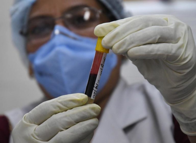 COVID-19: PORTUGAL REGISTA HOJE TRÊS MORTOS E 390 NOVOS CASOS DE INFEÇÃO