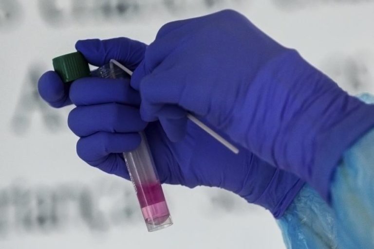 COVID-19: PORTUGAL ULTRAPASSOU HOJE 100 MIL CASOS DESDE O INÍCIO DA PANDEMIA
