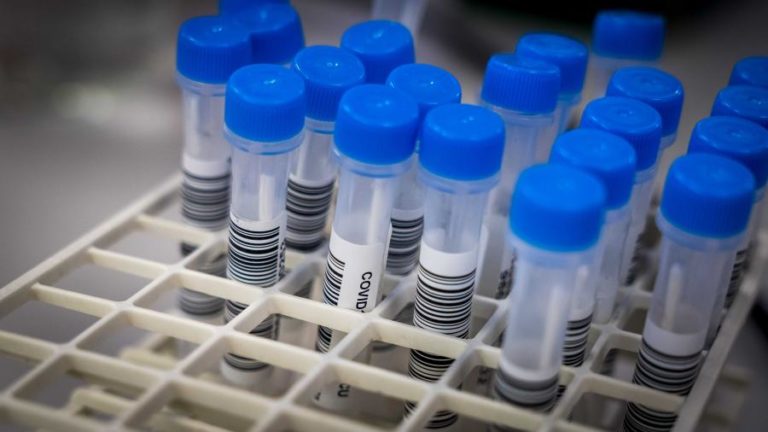 COVID-19: PELO MENOS 13 INFETADOS EM SURTO LIGADO A VALÊNCIAS DA MISERICÓRDIA DE VILA VIÇOSA