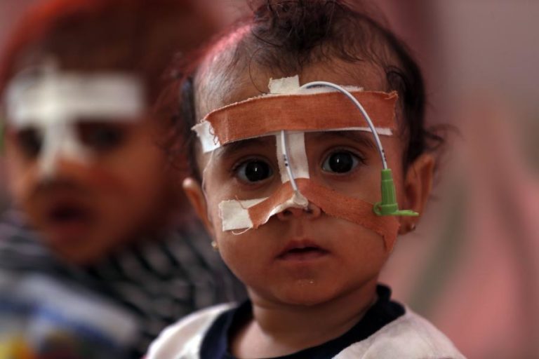 IÉMEN: DESNUTRIÇÃO INFANTIL SEM PRECEDENTE DESDE O INÍCIO DA GUERRA EM 2014 — ONU