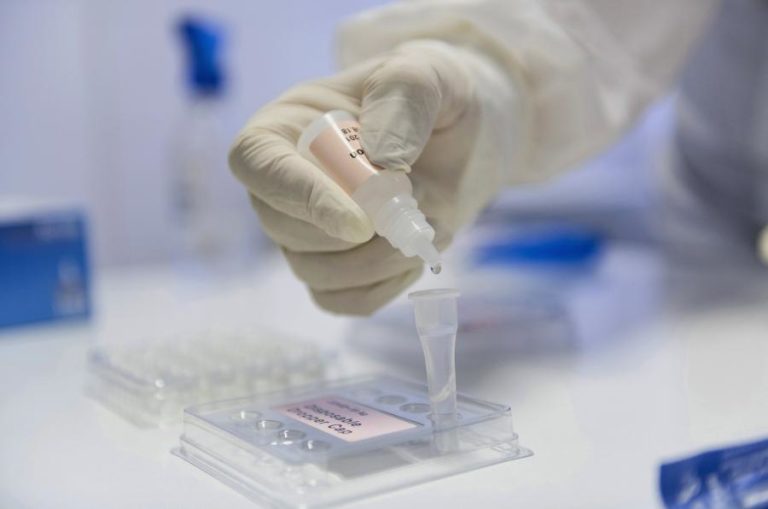 COVID-19: AÇORES COM 37 NOVOS CASOS E UMA MORTE APÓS SEIS MESES SEM ÓBITOS