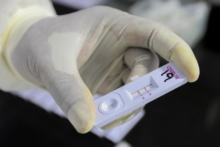 COVID-19: AÇORES COM 56 NOVOS CASOS, A MAIORIA EM SÃO MIGUEL