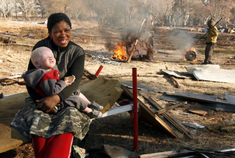 Governo guineense inicia recenseamento de pessoas com albinismo