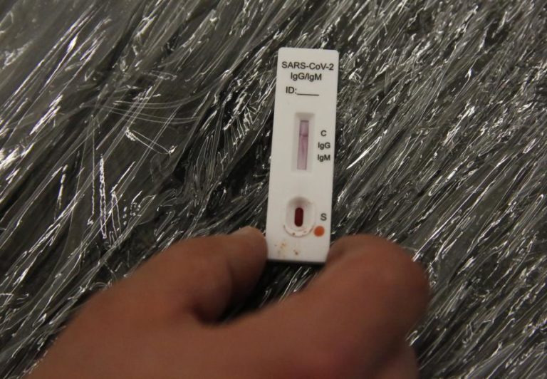 Covid-19: Maioria dos novos casos dos Açores é da estirpe inglesa