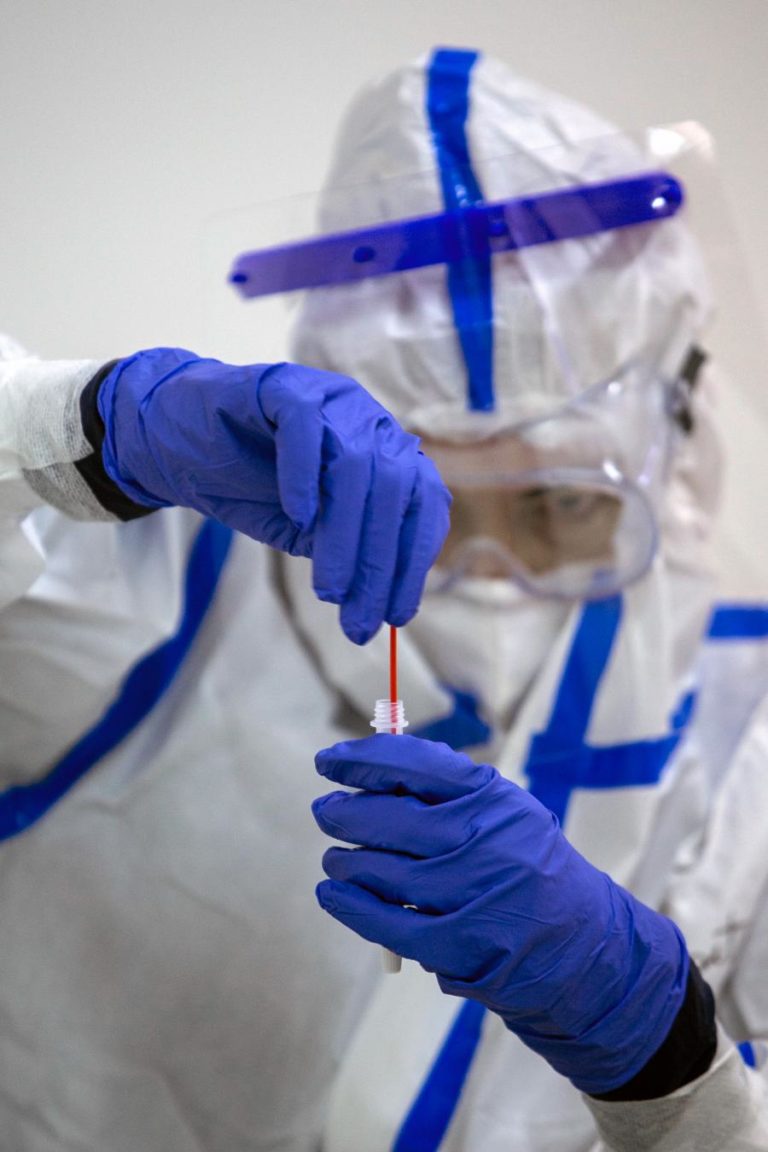 Covid-19: Taxa de positividade dos testes de diagnóstico é de 1,2%