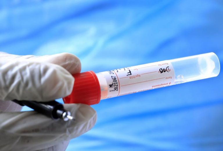 Covid-19: Mais de 127,5 milhões de infetados em todo o mundo