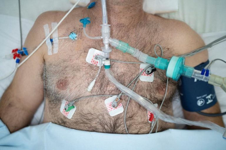 Covid-19: Estudo indica que Brasil pode chegar a 5.000 mortes diárias