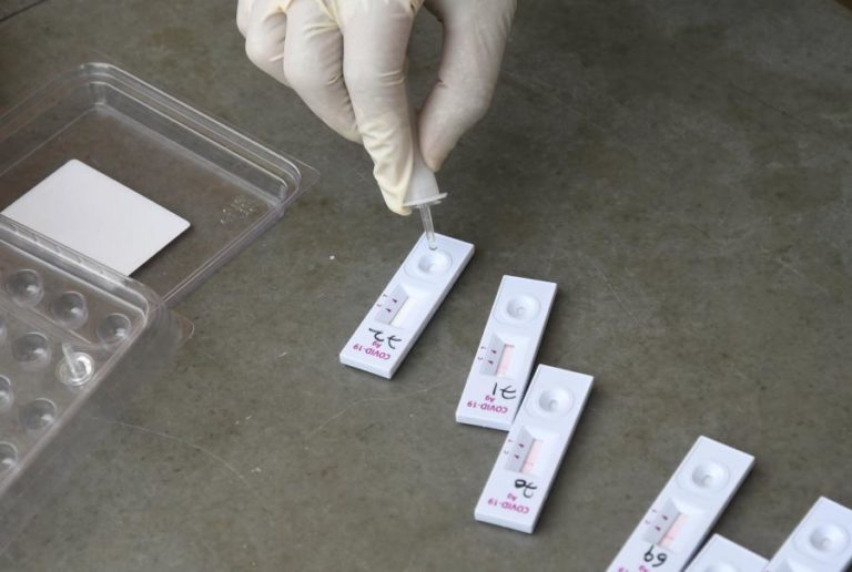 Covid-19: Conselho de investigação espanhol oferece tecnologia de testes para fabrico em África