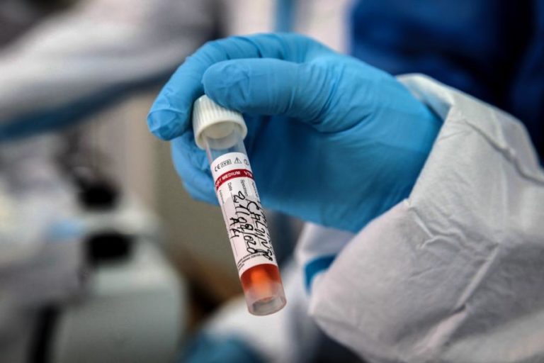 Covid-19: Angola reporta 269 novos casos, três óbitos e 62 recuperações