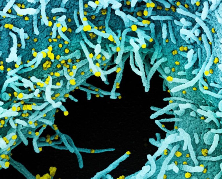 Covid-19: Cientistas impedem ‘in vitro’ replicação do coronavírus nas células humanas