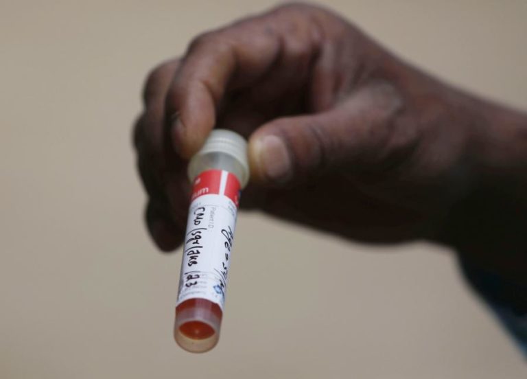 Covid-19: Guiné-Bissau regista mais 10 casos de infeção