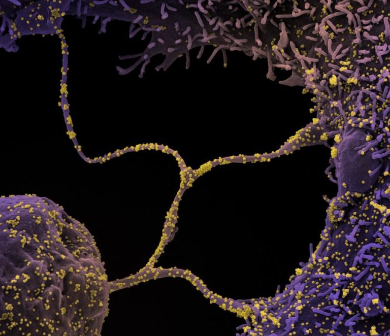 Covid-19: ECDC estima que variante Delta represente 90% dos casos na UE em agosto