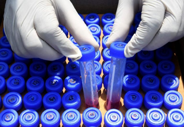 Covid-19: Madeira reporta sete novos casos e 84 situações ativas