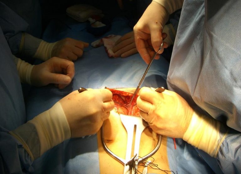 Transplantes de órgãos subiram 19% no primeiro semestre