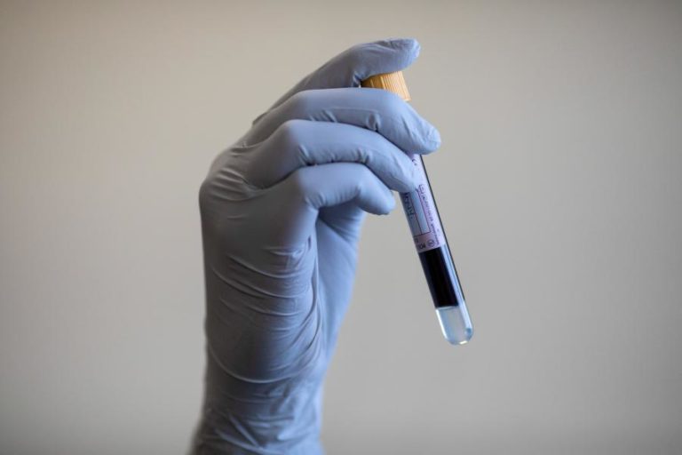 Covid-19. São Tomé e Príncipe com mais 91 casos e 15 recuperações em 24 horas