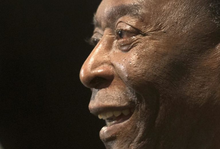 Pelé a recuperar bem de operação a um tumor no cólon
