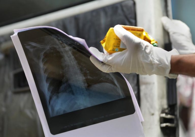 Covid-19: Pandemia matou pelo menos 4,7 milhões de pessoas em todo o mundo