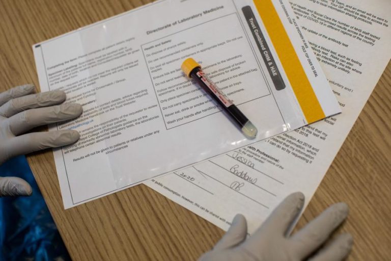 Covid-19: Erro em laboratório britânico poderá ter provocado 43 mil falsos negativos