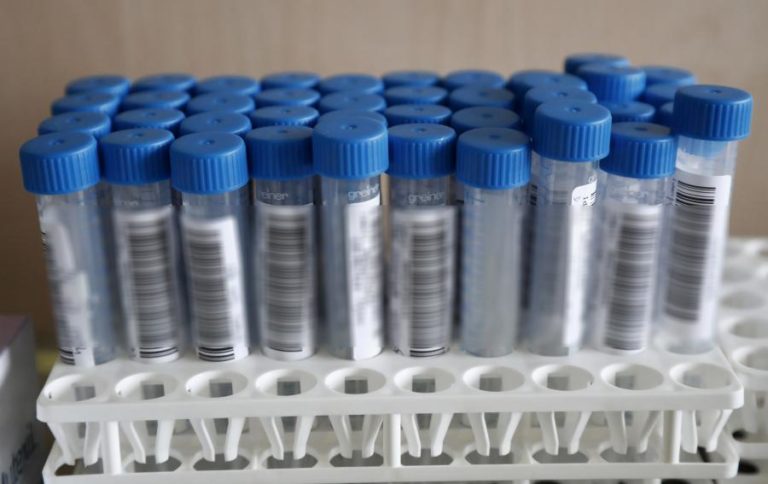 Covid-19: Mais uma morte e 13 novas infeções em São Tomé e Príncipe