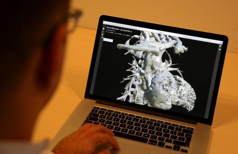 Politécnico da Guarda usa técnica de impressão de órgãos para tratamento de doenças cardiovasculares