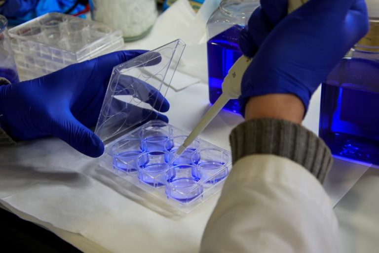 Nigéria confirma 21 casos de Monkeypox desde o início do ano