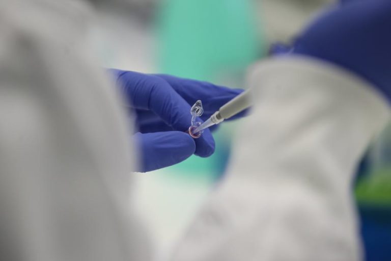 Descoberto mecanismo que desagrega das células proteínas ligadas ao Alzheimer