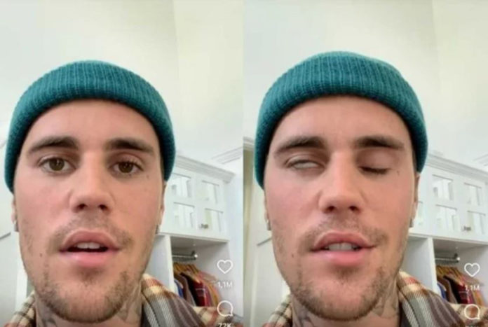 Foto: Justin Bieber/Instagram