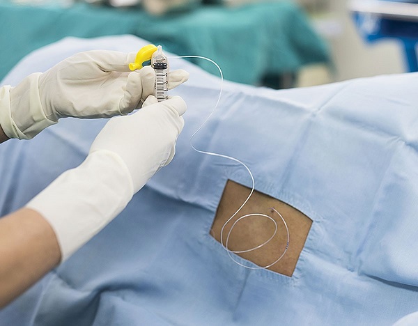 Foto: Anesthesia Patient Safety Foundation Foto: Anesthesia Patient Safety Foundation