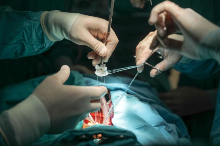 Cirurgia rara no D. Estefânia separou com êxito siamesas de quatro anos