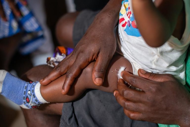 Governo são-tomense conta com parceiros para eliminar paludismo até 2030