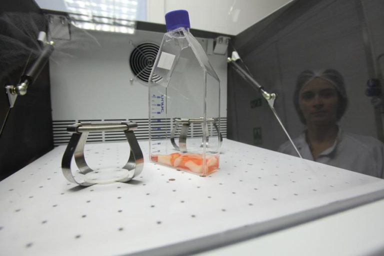 Cientistas criam células para tratamento da doença de Machado-Joseph