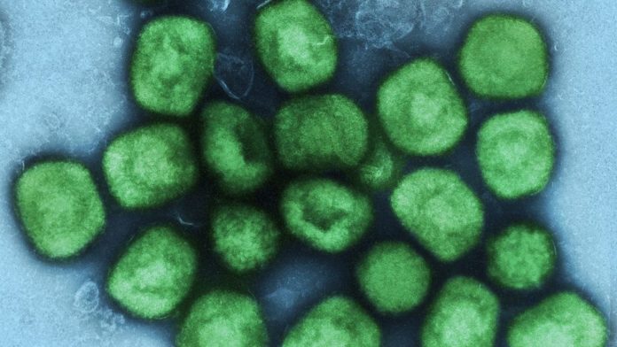 B1-02-VT EMERGÊNCIA GLOBAL AUMENTO MPOX RS 081524