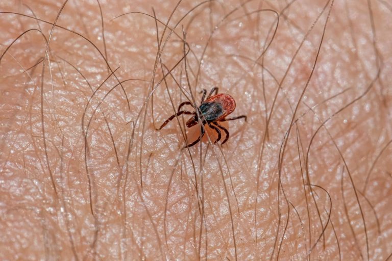 Saúde: Aumento de carraças faz subir casos de doença de Lyme no Canadá