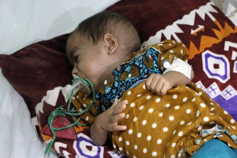 Três milhões de crianças com menos de 5 anos em subnutrição aguda no Afeganistão