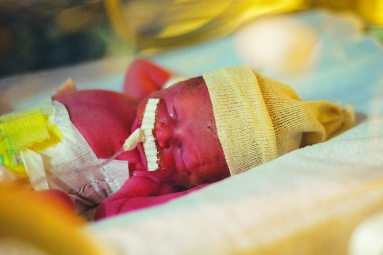 Seis casos e uma morte de sarampo congénito em Ontário, mães não estavam vacinadas