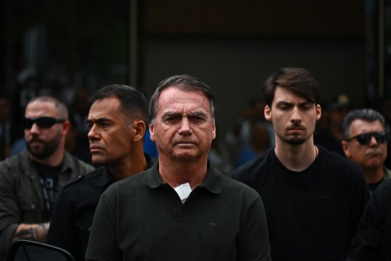 Bolsonaro tem um problema renal e vai permanecer hospitalizado