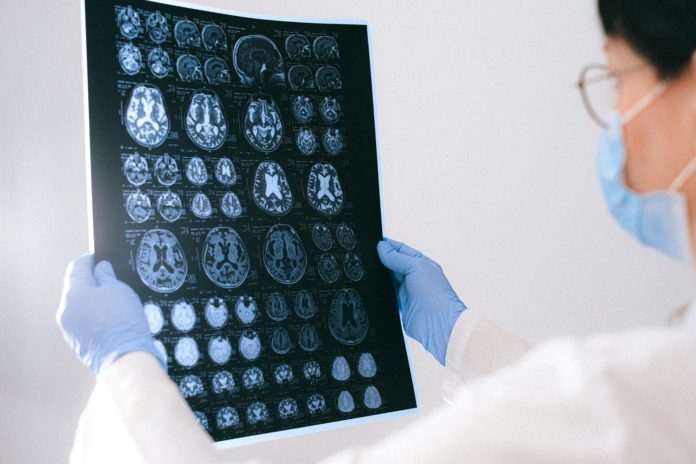 B2-03-VT ESTUDO TRATAMENTO ALZHEIMER LITIO