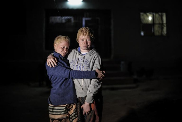 Perita da ONU diz que educação pode travar perseguição a pessoas com albinismo em África