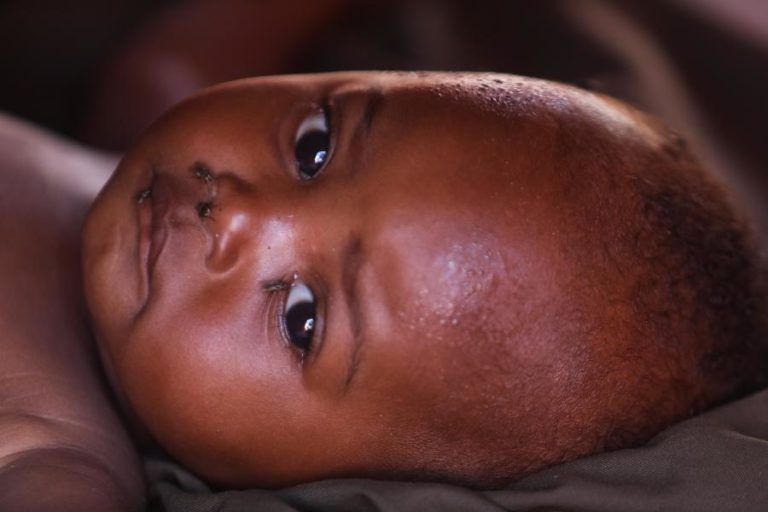 OMS considera “antiético” estudo de vacinas financiado pelos EUA na Guiné-Bissau