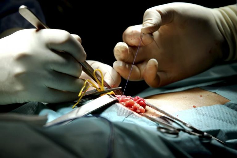 Mais de 13.400 utentes aguardavam por uma cirurgia nos Açores no final de fevereiro