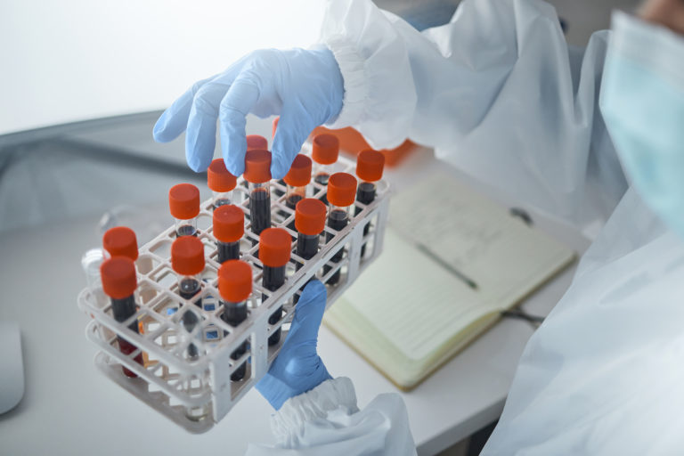 Estudo da Universidade de Guelph identifica nova via promissora no combate à leucemia